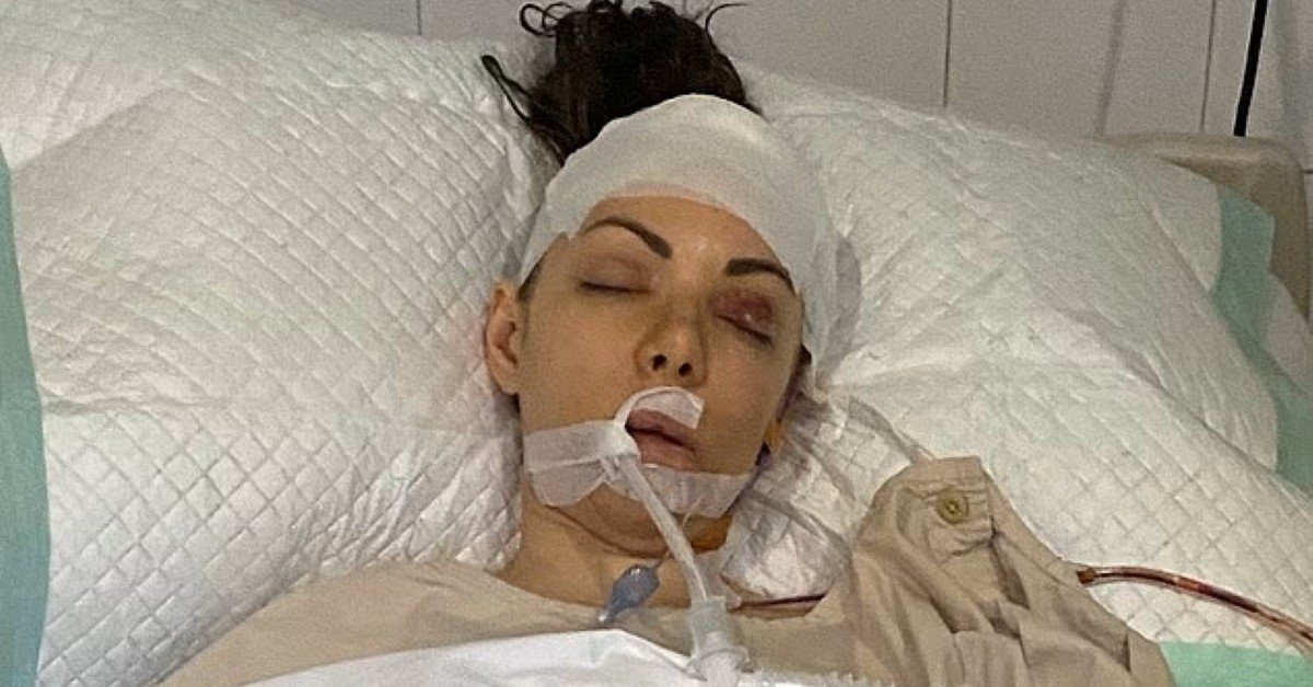 Страховая отказалась покрывать медрасходы уроженки Москвы, которая получила травмы головы во время отдыха на Бали